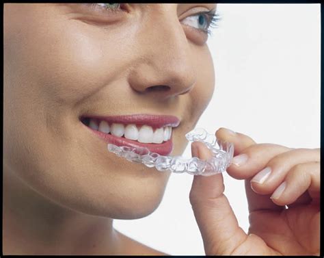 Best Invisalign Dentist Near Me Ocala Fl Smart Dental Blogsmart