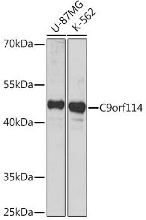 Anti C9orf114 抗体 Cab18460 Assay Genie