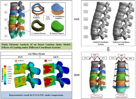 Finite Element Analysis Of An Intact Lumbar Spine Model Effects Of