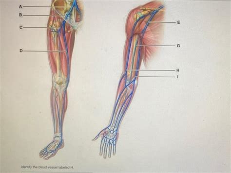 Solved A B E с G D H Identify the blood vessel fabeled H Chegg