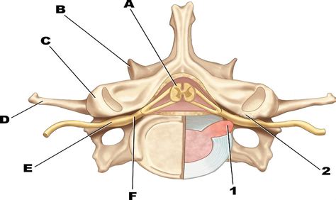 Commentary: Lumbar Lateral Recess Decompression: 2-Dimension ...