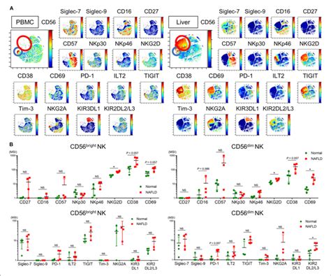 Phenotype Of Intrahepatic And Peripheral Blood Nk Cells From Nafld