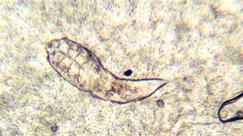 How To Find Face Mites Migratory Legends