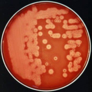 Clostridium Perfringens