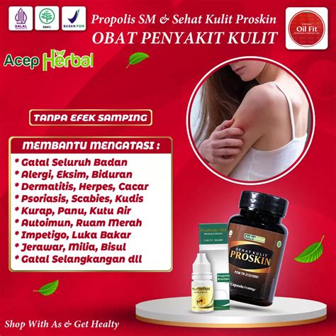 Jual Obat Psoriasis Gatal Kulit Kepala Panu Kurap Gatal Selangkangan