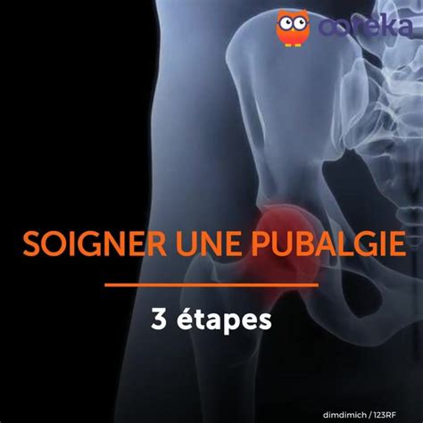 Soigner Une Pubalgie Vid O Dailymotion