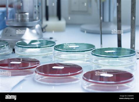 Bacteria Growing In Petri Dishes In Lab Stock Photo Alamy