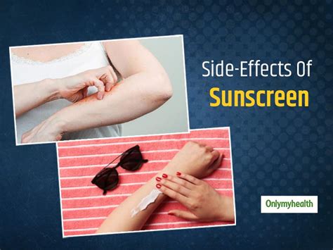 Know The Side-Effects Of Sunscreen On Skin And Tips To Use Sunscreen ...