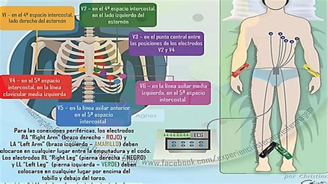 Tecnica De Electrocardiograma Ppt