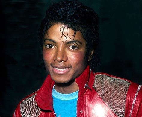 Vitiligo Michael Jackson