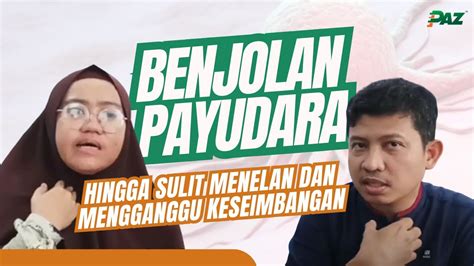 Benjolan Pada Payudara Dan Susah Untuk Menelan Kenapa Tidak Ikhtiar