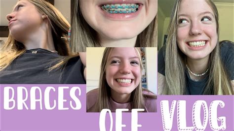 Braces Off Vlog Getting My Braces Off Youtube