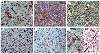 Ng Mcsp Antibody Nbp Novus Biologicals