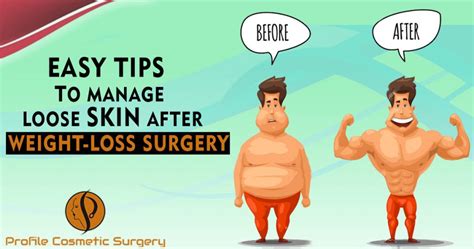 Easy Tips To Manage Loose Skin After Weight Loss Surgery Blog