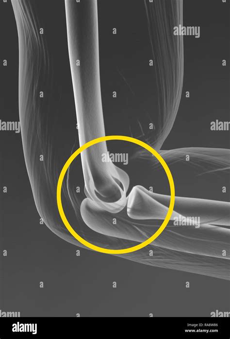 Articulaci N Del Codo M Dicamente Ilustraci N D Fotograf A De Stock