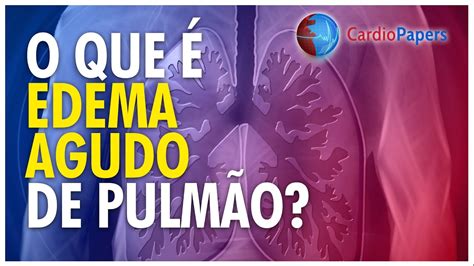 Cuidados De Enfermagem Edema Agudo De Pulmão