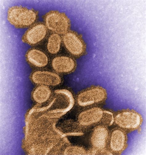 Electron Micrograph Of 1918 Influenza Virus Biology Of Human World Of