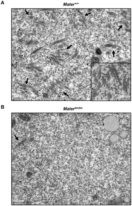 A Representative Tem Image X11500 Of The Ultrastructure Of Download Scientific Diagram