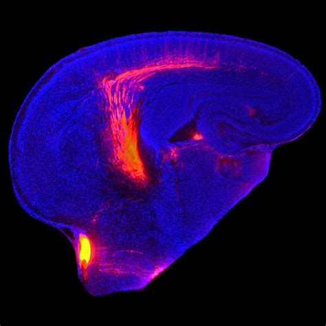 Same gene dictates size of two sensory brain areas - Salk Institute for ...