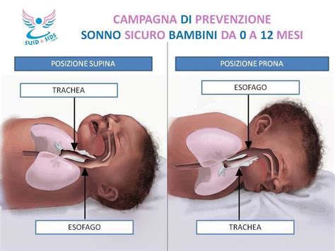 Posizione Antireflusso Per Far Dormire Il Neonato Matteo Silva