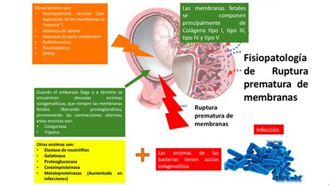 Fes Iztacala Medicina Tutorias Ruptura Prematura De Membranas