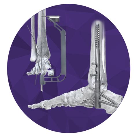 Paragon 28 Advances In Orthopaedics