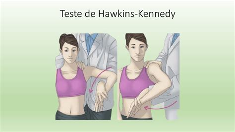 Teste De Hawkins Kennedy YouTube