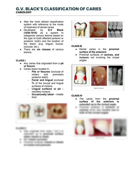 SOLUTION: G v black s classification of caries 1 - Studypool