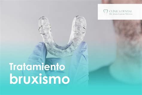 Los Mejores Tratamientos Para El Bruxismo En Ja N Cl Nica Dental Ja N