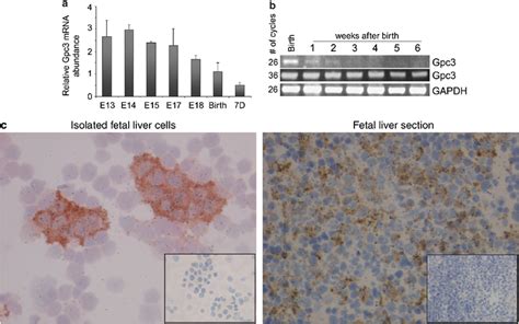 Expression Of Gpc3 Mrna In Rat Liver During Development A Relative Download Scientific