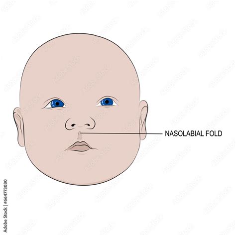 nasolabial fold  nasolabial fold    descends   wing