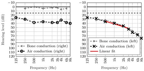 5 Air Conduction And Bone Conduction Ptas Of An Individual With Download Scientific Diagram