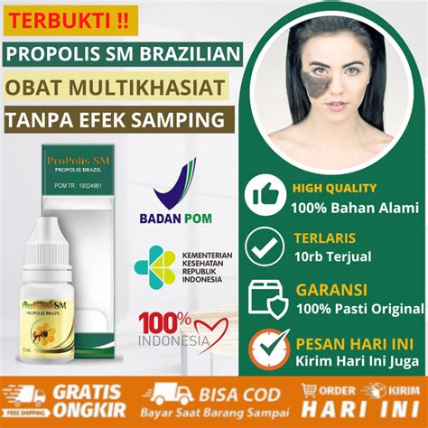 Jual Obat Penghilang Tanda Lahir Hitam Coklat Merah Di Wajah Obat