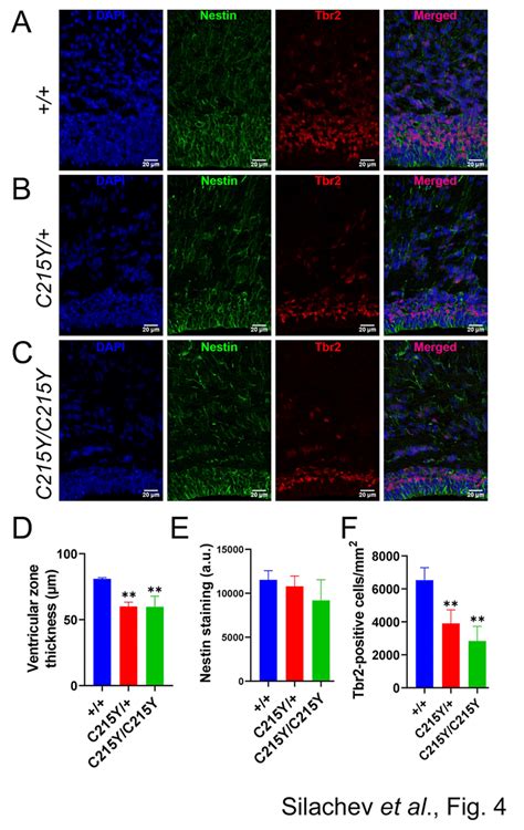 C215y Mutation In Gnao1 Gene Affects Cortical Neural Progenitor Cells