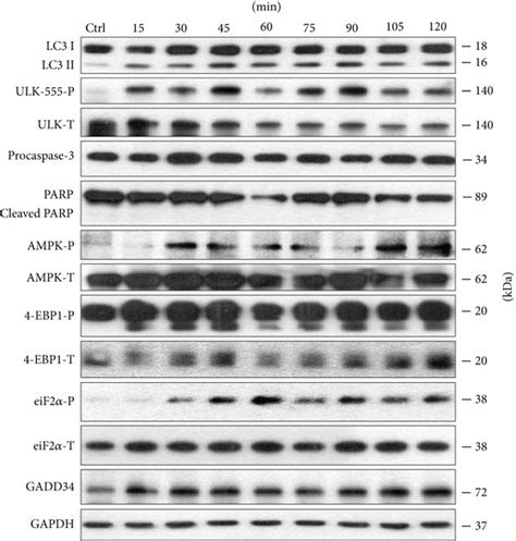 Egcg Pretreatment Extends Autophagy Dependent Survival With Respect To