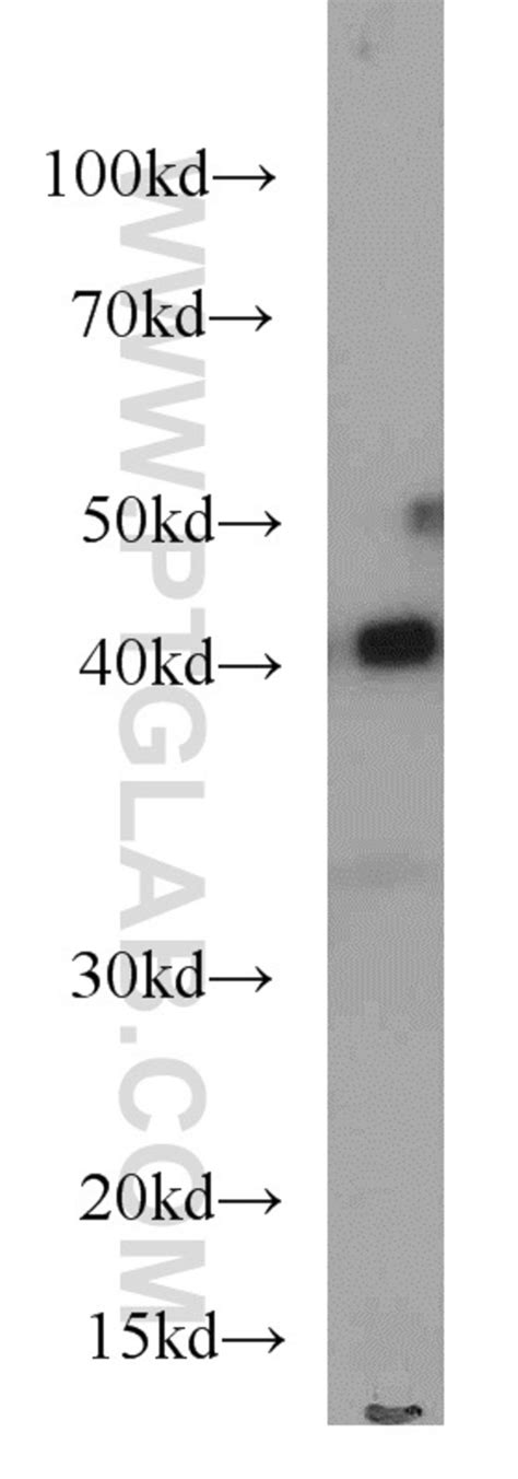 Ass1 Mouse Anti Human Mouse Porcine Rat Clone 1d1a11 Proteintech