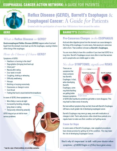 Esophageal Cancer Flyer Side 1 Palmer General Surgeon Mat Su