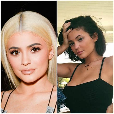 Kylie Jenner Removed Her Lip Filler Teen Vogue