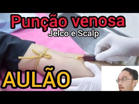 Punção venosa jelco punção venosa scalp AULÃO