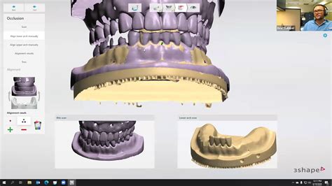 Digital Dentistry Training Series Advanced Denture Design Youtube