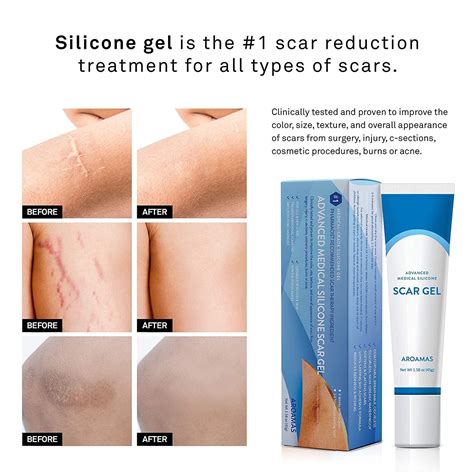 Aroamas Scar Gel Professional Grade Advanced Scar Removal Treatment