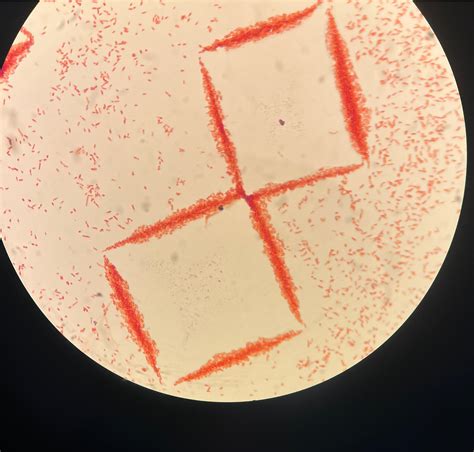 E Coli Gram Stain Arrangement