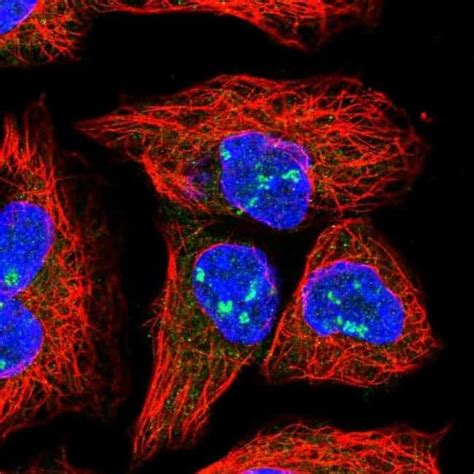 HEATR1 Polyclonal Antibody Invitrogen 100 μL Unconjugated Antibodies