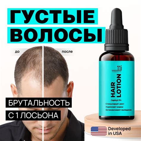 Лосьон для роста волос, бороды и усов. Сыворотка Капиксил 5% средство ...