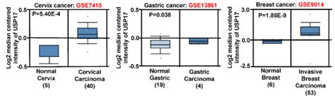 Macrophages Promote Progression Of Lung Cancer By Regulating Ubiquitin