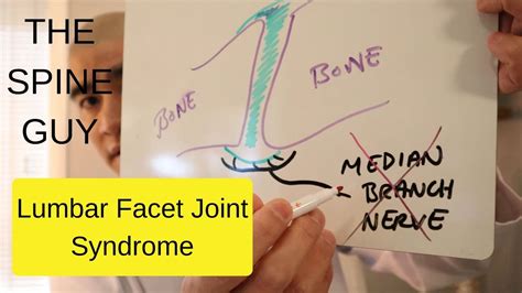 Lumbar Facet Joint Syndrome Youtube