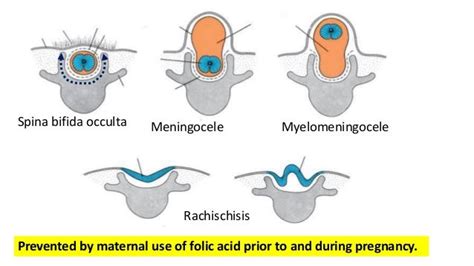 Development of nervous system