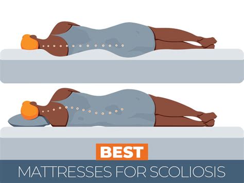 98 Beautiful Best Mattress For Scoliosis 2024 Trend Of The Year