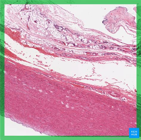 Blood Vessels Histology And Clinical Aspects Kenhub