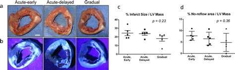 Infarct Size And No Reflow Area 1 Week After Mi A Representative